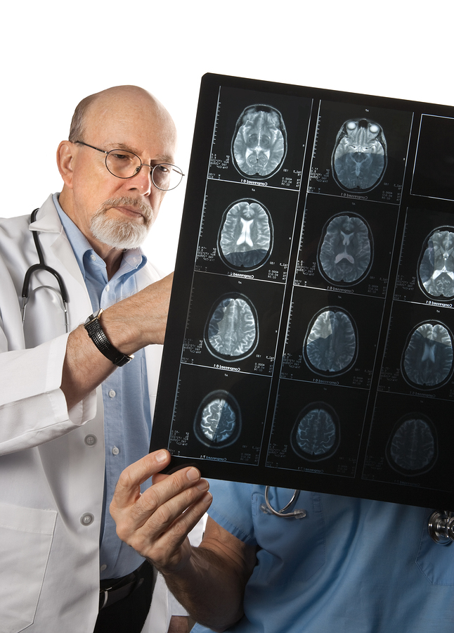 doctor reviewing brain scans