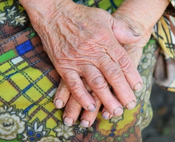 dirty hands/nails of an elderly woman living at a nursing home