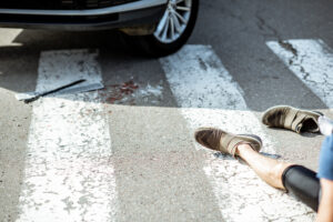 Information for Pedestrians Who Are Hit by a Car Braunslaw