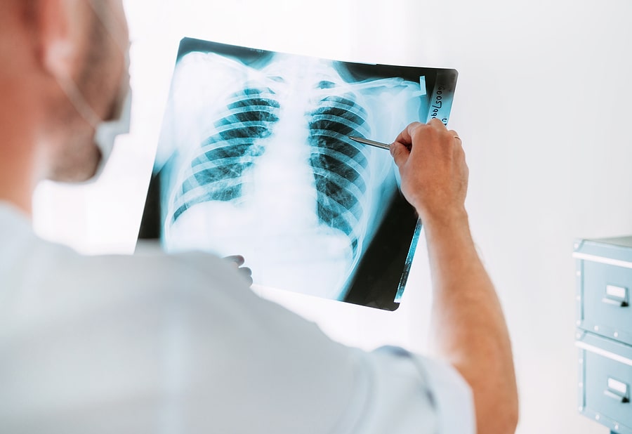 chest xray after an accident being examined by a radiologist