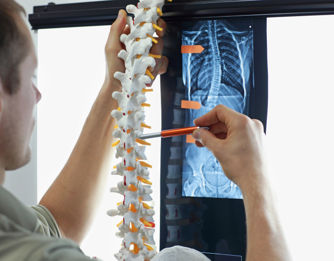 spinal cord injuries