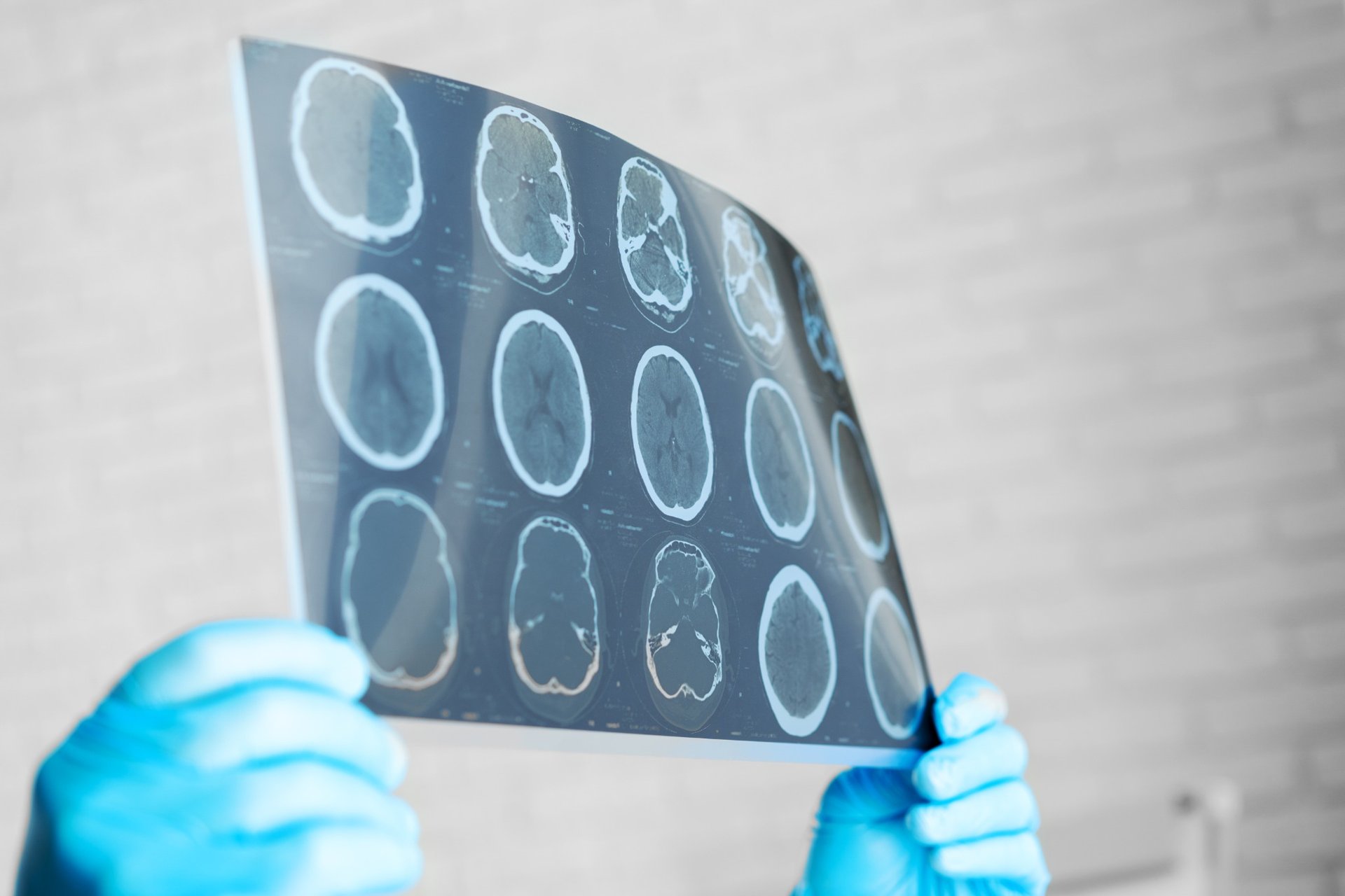 Doctor examining brain MRI scan with protective gloves